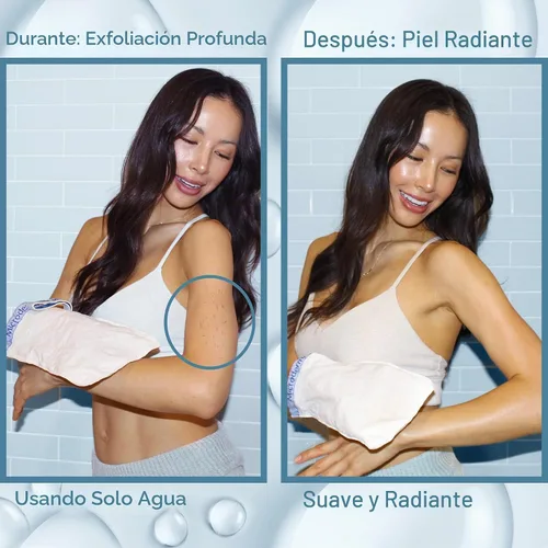 Vista 5 de MicrodermaMitt Manopla exfoliante profunda original para cuerpo, removedor de piel turco Kessa muerta y exfoliante corporal para queratosis pilaris