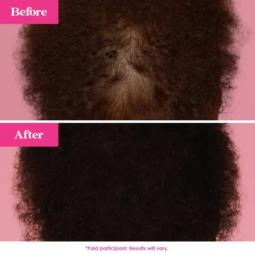 Vista 5 de Grande Cosmetics GrandeHAIR - Suero potenciador del cabello para hombres y mujeres, promueve el grosor en el cabello fino, seguro para cabello teñido