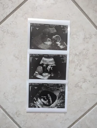 Vista 6 de Broma 2D personalizada tira de ultrasonido falso de 3 fotos