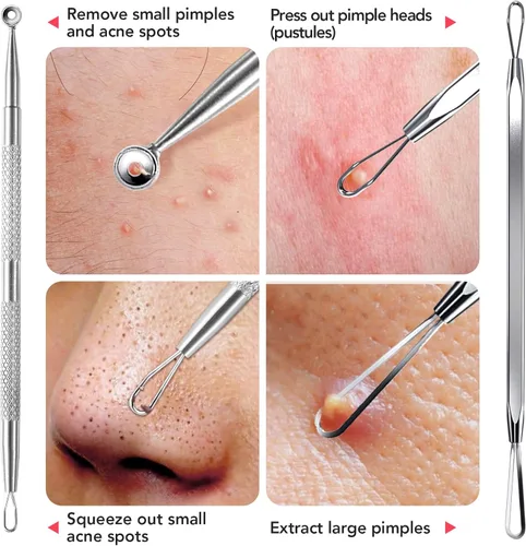Vista 6 de Litbear - Juego de herramientas para eliminar puntos negros, 6 unidades Blackhead Pimple Comedones Extractor, Acne Tools Extractor kit, Scraper