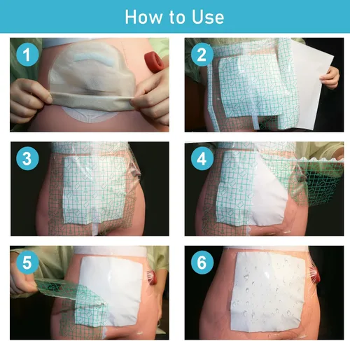 Vista 6 de 25 piezas de bolsa de ostomía impermeable cubierta de ducha de 10 x 10 pulgadas, protector de baño de estoma protector de película adhesiva vendaje
