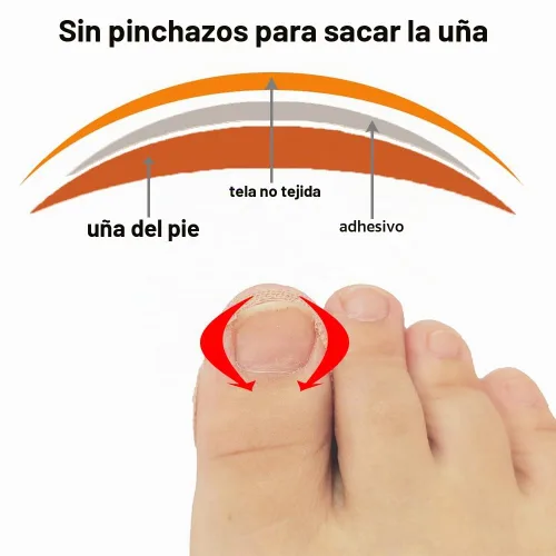 Vista 4 de Tratamiento de uñas encarnadas, 50 parches correctores de uñas encarnadas, calcomanías de corrección de uñas de los pies, herramienta profesional