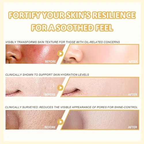 Vista 6 de FOR SADOER Rice Niacinamide Skincare Set – Kit de 6 piezas de cuidado de la piel reafirmante con limpiador, tónico, loción, crema para los ojos