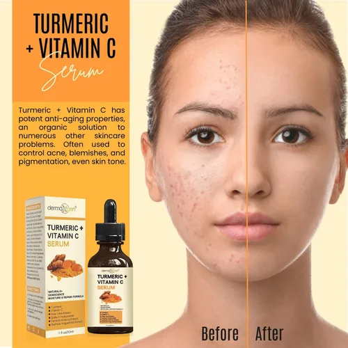 Vista 7 de Suero facial de cúrcuma + vitamina C, tratamiento orgánico para el acné, tono de piel claro, hidrata la piel opaca y seca, suero facial
