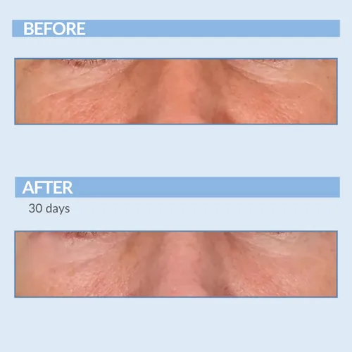 Vista 8 de Serious Skincare Vitamin A Force XR Retinol suero concentrado facial, micro exfoliante y rejuvenecimiento para piel radiante, para líneas, arrugas