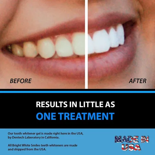 Vista 4 de Bright White Smiles Paquete de recarga de jeringa de gel blanqueador dental de peróxido de carbonamida al 44 % paquete de recambio de peróxido