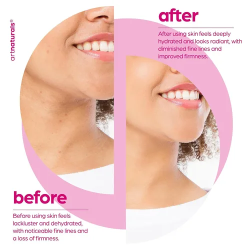 Vista 6 de ArtNaturals - Suero de colágeno potenciador para la cara, antienvejecimiento, reduce las arrugas y aumenta el colágeno, cura y repara la piel