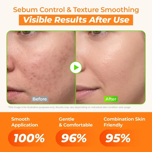 Vista 3 de JUMISO Suero vitamínico para todo el día, suero facial iluminador y equilibrante, regalo, vitamina C, A, B, D, E, suero con vitaminas, cuidado