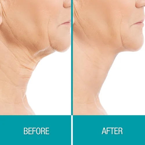 Vista 3 de Dermactin Crema reafirmante para la piel crepé 2.5 oz.