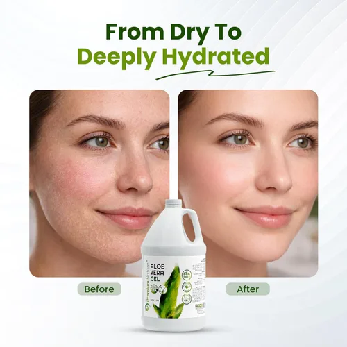 Vista 4 de Premium Nature Gel puro de aloe vera para rostro y piel seca, alivio de quemaduras solares, gelatina hidratante de piel de Aloe Vera Plant