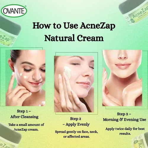 Vista 5 de Acne Zap Crema a base de azufre para cara, tratamiento eficaz del acné con azufre blanco, aceite de árbol de té y óxido de zinc para adultos