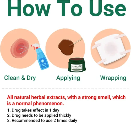 Vista 6 de LMNOOP® Crema de cuidado perianal, heridas de curación rápida para fisura del ano, absceso, úlcera, infección, cirugía posparto y fístula anal