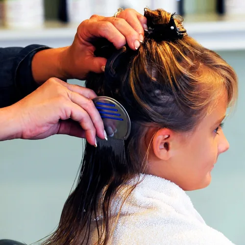 Vista 5 de My Hair Helpers Peine eliminador de piojos – Acero inoxidable – Elimina eficazmente piojos, liendres y superpiojos del cabello – Para 1-2 niños