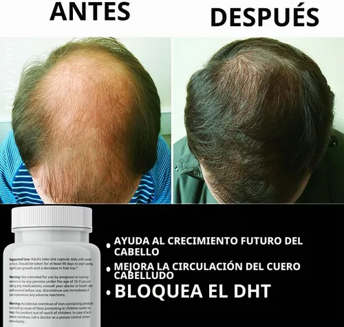 Vista 6 de Finanutride Natural DHT Blocker & Cápsulas de crecimiento del cabello para prevenir la pérdida de cabello, estimular los folículos capilares