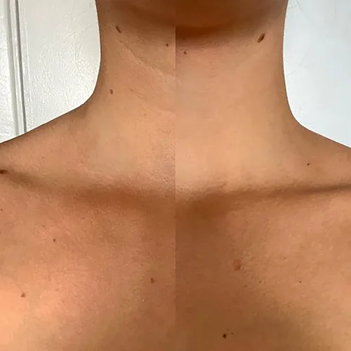 Vista 5 de Suero rejuvenecedor de cuello y pecho para mujeres, ayuda a hidratar y revivir tu piel, ilumina muy rápidamente una piel hermosa, ayuda a acelerar