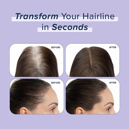 Vista 4 de TRUHAIR Polvo prensado para cubrir raíces y cuero cabelludo, compacto, impermeable, cobertura ligera del cabello y encubrimiento de puntos calvos