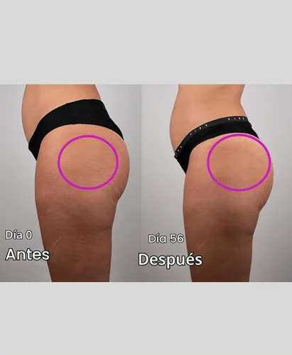 Vista 3 de DropOff Crema para la celulitis, crema escultora reafirmante corporal, 3.4 fl oz Skin firming and tightening lotion, targets cellulite, stretch