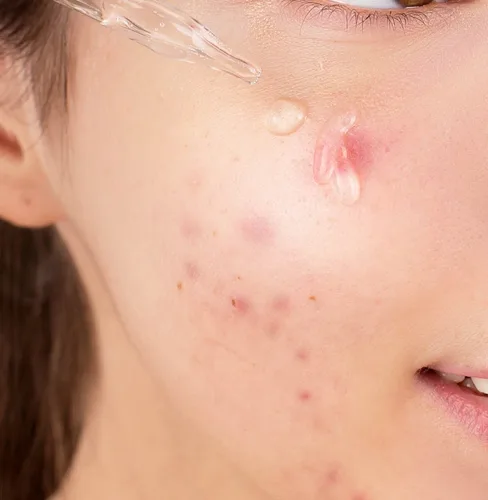 Vista 7 de Suero coreano para el cuidado de la piel con vitamina B, suero C para la cara, niacinamida, 10% de zinc, 1% y 1%, suero facial hidratante K Beauty