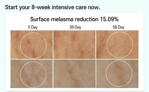 Vista 5 de Tratamiento de melasma para Face Cica Intensive Serum 1.01fl.oz/1.0 fl oz