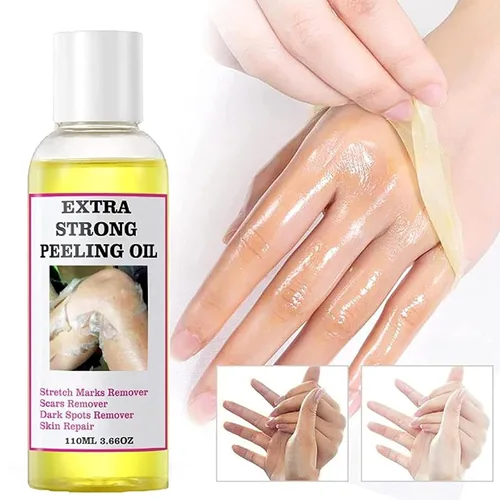 Vista 2 de Generic Aceite pelador amarillo extra fuerte para piel oscura, solución exfoliante para cuerpo, manos, pies y cara, todo