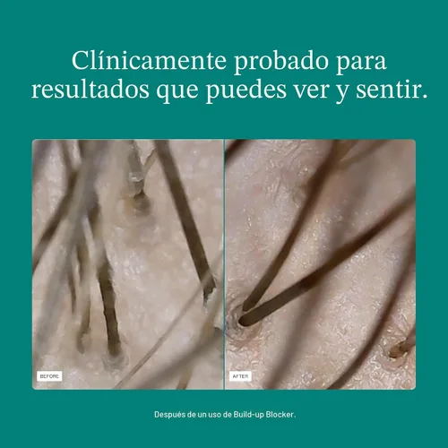 Vista 4 de Nutrafol Máscara Exfoliante para el Cuero Cabelludo, Elimina la Acumulación de Productos y el Aceite para un Cabello y Cuero Cabelludo Más