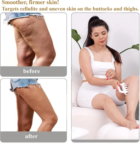 Vista 3 de Herramienta de masaje fascia, herramientas de masaje de punto de activación, anti blaster, herramienta de masajeador de celulitis, herramienta