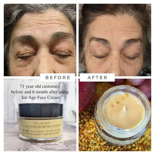 Vista 4 de Ice Age - Crema facial antienvejecimiento para hombres y mujeres con aceite de semilla negra, polen de abeja/pan de abeja, retinol, ácido