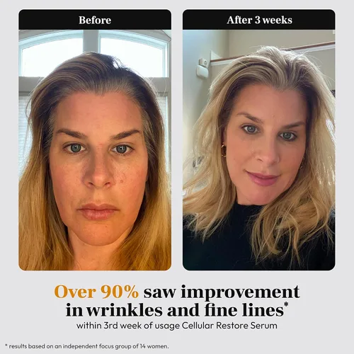 Vista 6 de Suero orgánico de vitamina C para manchas oscuras y piel menopáusica con ciruela Kakadu y suero de retinol orgánico para mujeres menopáusicas