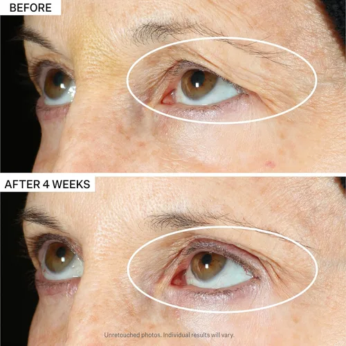 Vista 7 de StriVectin Crema corporal Tighten & Lift Crepe Control Corporal, Aprieta y Levanta Peptight Suero de Ojos de 360 Grados y Aprieta y Levanta el Suero