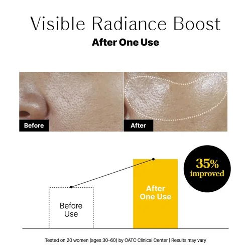 Vista 6 de Glow Aurora Serum – Gotas ligeras coreanas brillantes para la cara con niacinamida, ácido hialurónico y luteína, suero de brillo facial para una tez