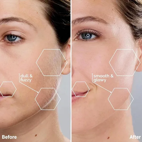 Vista 4 de Kradaa Depilación facial para mujeres: maquinilla de afeitar facial eléctrica con luz LED, mini afeitadora sin dolor y resultados instantáneos