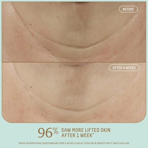 Vista 3 de Biossance Squalane + Firm & Lift Dual Serum - Suero facial para piel madura - Levanta e hidrata - Reduce las arrugas - Ácido hialurónico, escualano