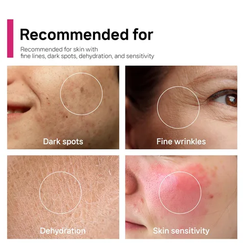 Vista 4 de Arbutin 7% + ácido tranexámico 5% + niacinamida 2% crema facial intensiva para el cuidado del tono, manchas oscuras, pecas, manchas, pigmentación