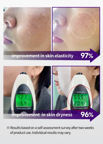 Vista 5 de BEAUDIANI Pepti Collagen Daily Sheet Mask (31 unidades) - Mascarilla facial hidratante y reafirmante con 7 colágenos, 6 péptidos y ácido hialurónico
