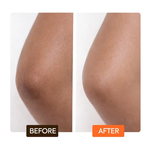 Vista 8 de MAKARI Carotonic Extreme Body Lotion (17.6 oz) Combate la producción excesiva de grasa Ayuda a desvanecer cicatrices y marcas corporales