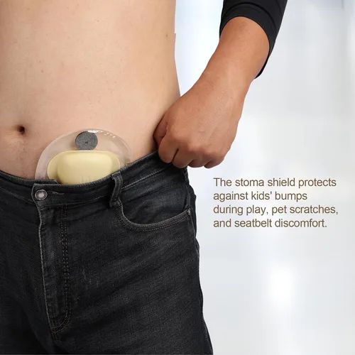 Vista 3 de Protector de estoma y 50 pares de calcomanías Máxima protección para tu bolsa de ostomía