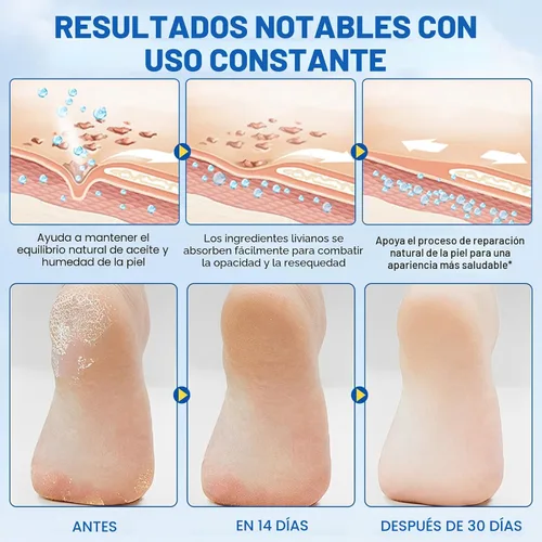 Vista 4 de Crema en barra de urea 60% más 2% ácido salicílico, crema de urea para pies y callos de máxima fuerza para talones secos agrietados, manos