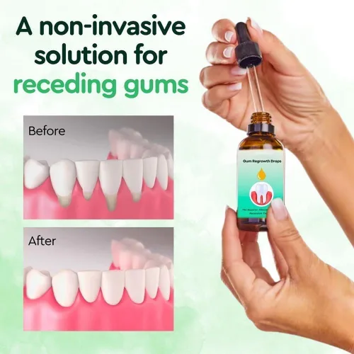Vista 2 de DentiZen - Gotas para aliviar las encías, gotas líquidas naturales para dientes y encías, 2