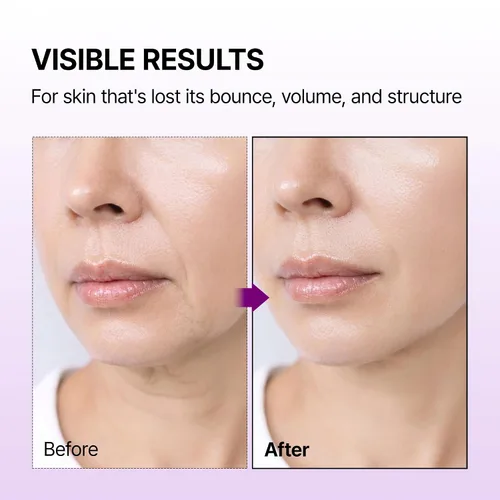 Vista 3 de Dr.Melaxin Crema facial de unión de calcio con REBORNIC 10,000 ppm y EGF, hidratante facial antienvejecimiento para densidad de piel, ceramida