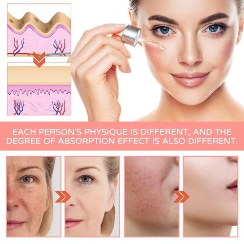 Vista 7 de Suero facial 5 en 1 con ácido hialurónico, niacinamida y vitamina C, suero antienvejecimiento para manchas oscuras, arrugas y acné, esencia de piel