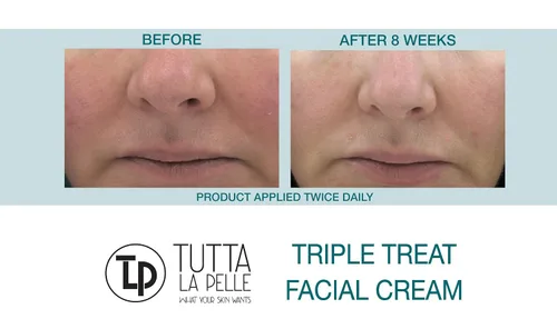 Vista 5 de Crema facial antienvejecimiento, triple antioxidante, suero de tratamiento para cara, resveratrol + té verde + cafeína, reduce visiblemente