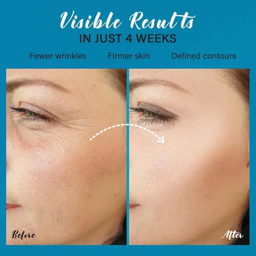 Vista 5 de Crema para el cuello Aprieta y Levanta: Crema de estiramiento facial instantáneo - Crema hidratante facial antienvejecimiento 6 en 1 para firmeza