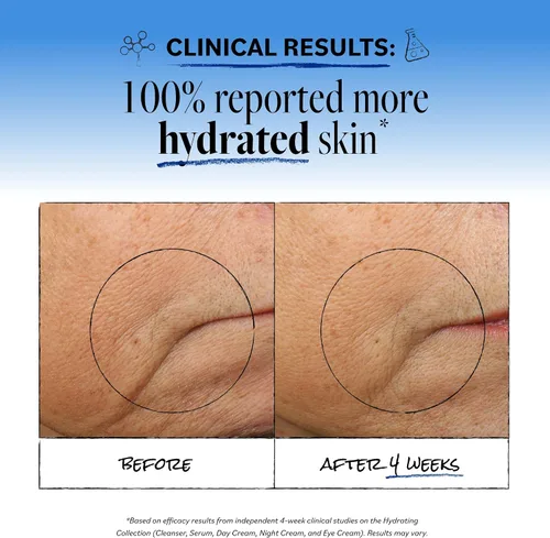 Vista 3 de Derma E Crema de día antioxidante ultra hidratante, hidratante facial con ácido hialurónico, escualano y ceramidas para suavizar y nutrir