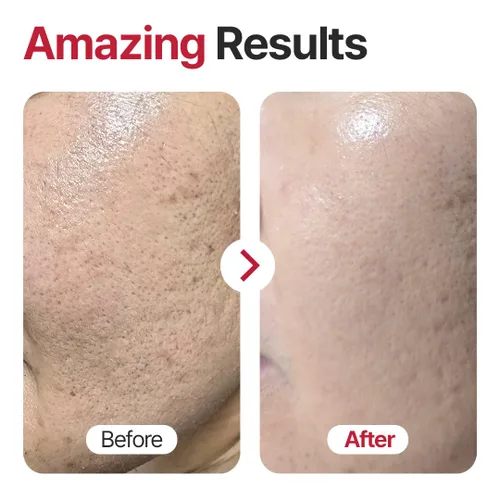Vista 9 de Cellu-Light Body Firming Stick & Lift Up - Juego de crema ligera, 1.76 onzas (1.76 oz), bálsamo corporal reafirmante para una piel más suave +