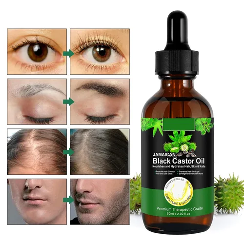 Vista 7 de Jamaican Pure - Champú de aceite de ricino negro prensado en frío y set de crecimiento, 10.56 onzas líquidas fortalece y restaura, champú