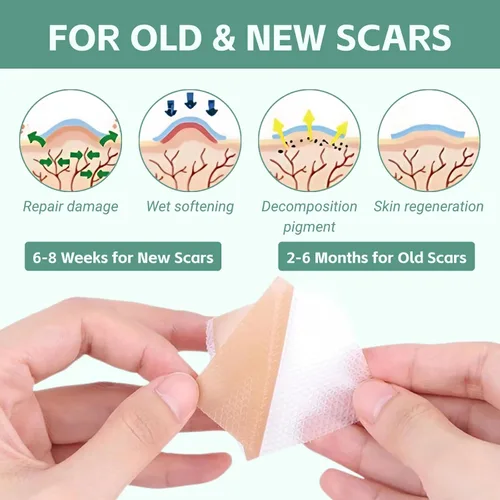 Vista 4 de Hojas de silicona para cicatrices, cinta de silicona para cicatrices quirúrgicas, impermeable, reutilizable, eliminación de cicatrices, rollo