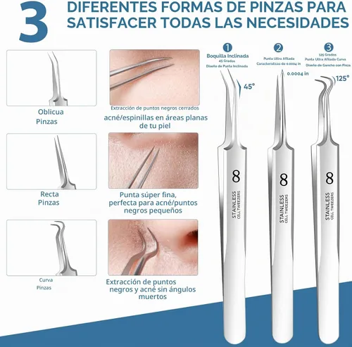 Vista 4 de Kit de herramientas para eliminar puntos negros, herramienta extractora de espinillas, herramienta extractora de espinillas, herramienta profesional