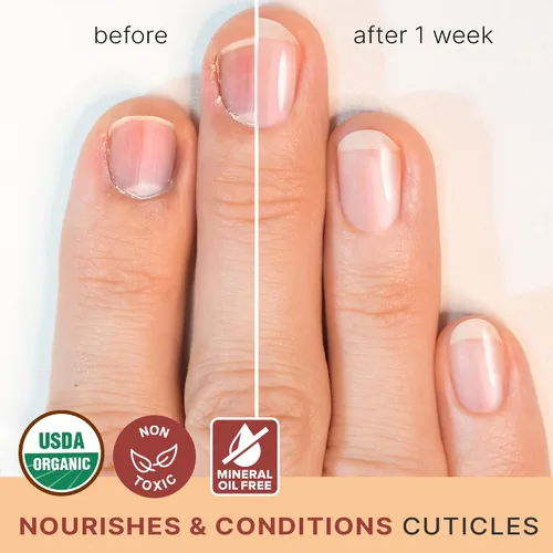 Vista 2 de Aceite orgánico para uñas y cutículas, aceite de uñas fabricado en Estados Unidos para crecimiento y fuerza con jojoba y vitamina E, reparación