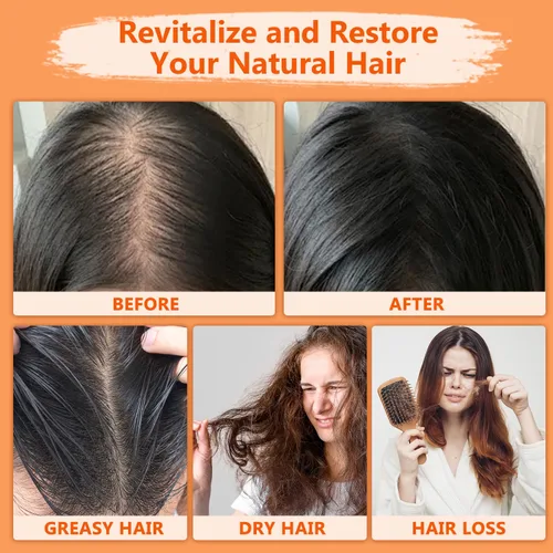 Vista 4 de Fórmula natural de Batana para el cabello, aceite de batana líquido 4 en 1, aceite de batana para cabello, aceite de romero para cabello