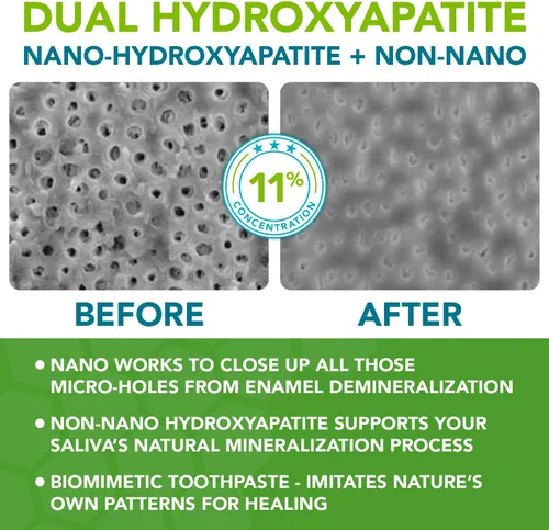 Vista 3 de Pasta de dientes nano hidroxiapatita libre de flúor; pasta de dientes remineralizante profesional formulada por dentistas más xilitol anticaries